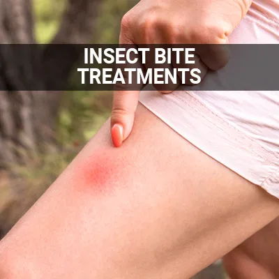 Visit our Insect Bites and Stings Treatments page