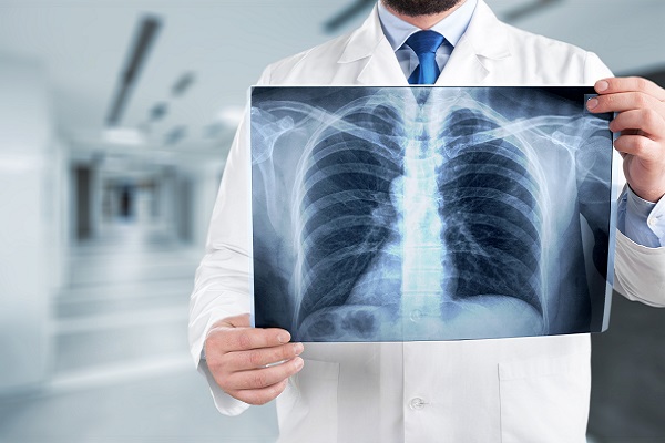 What Is Diagnosed By X Ray?